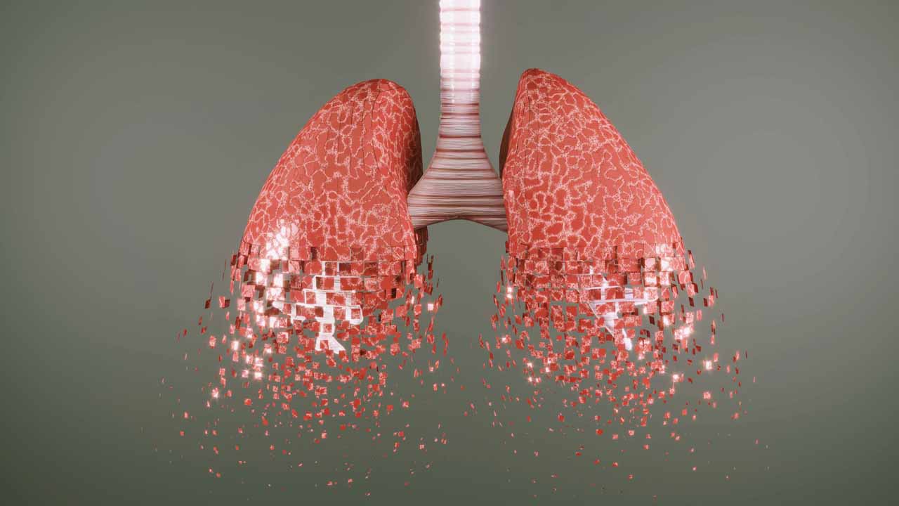 copd-main-image