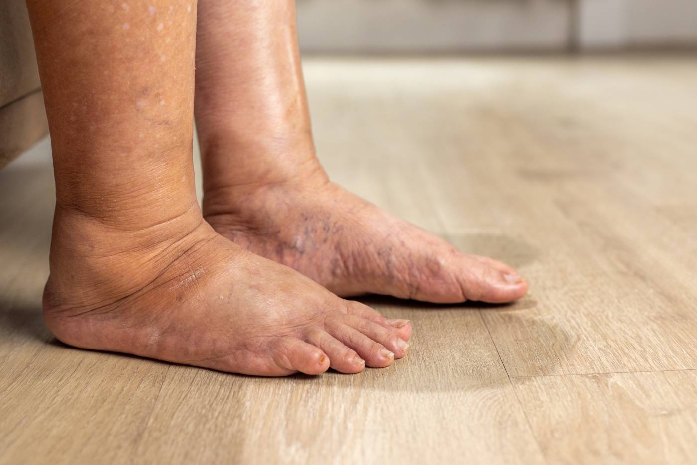 ankles-1