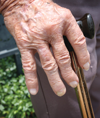arthritis_knobbly fingers_gs.jpg