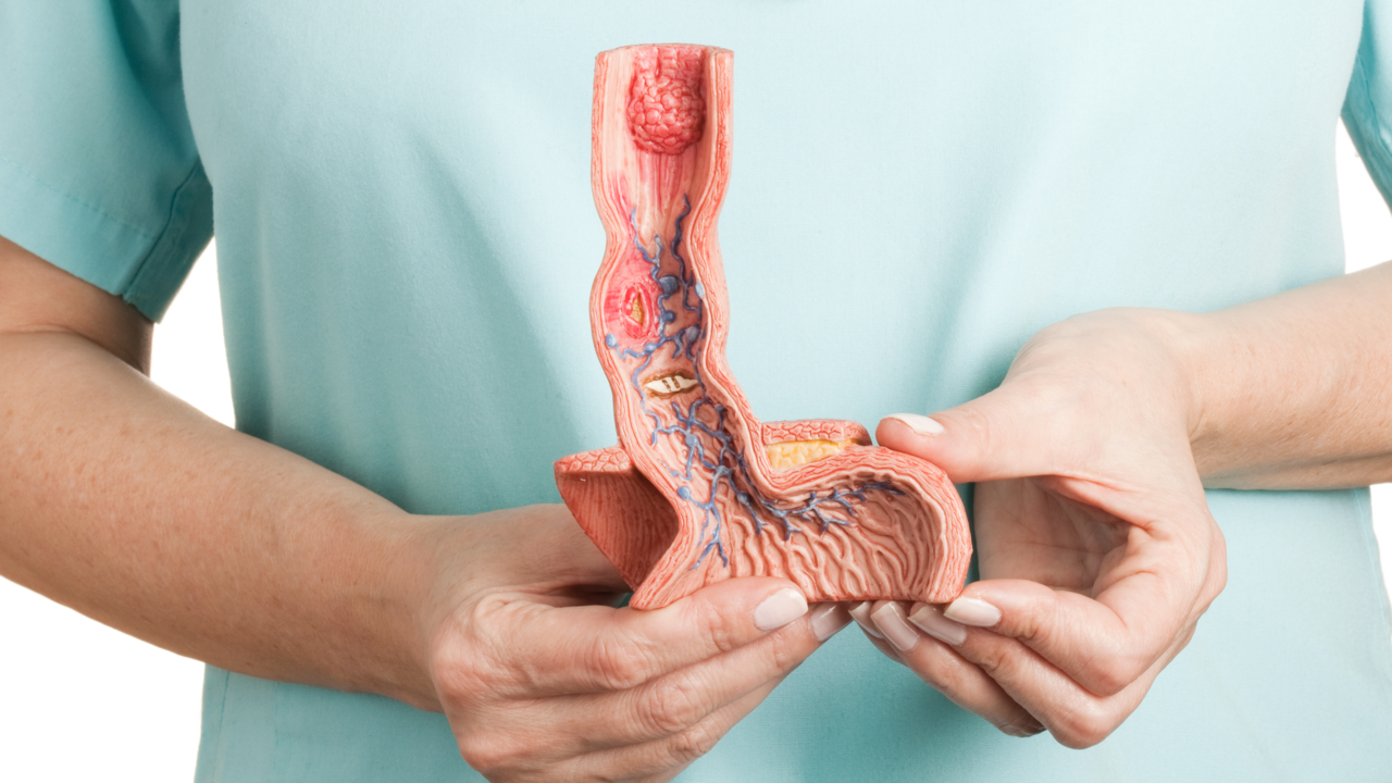 esophagus-1280