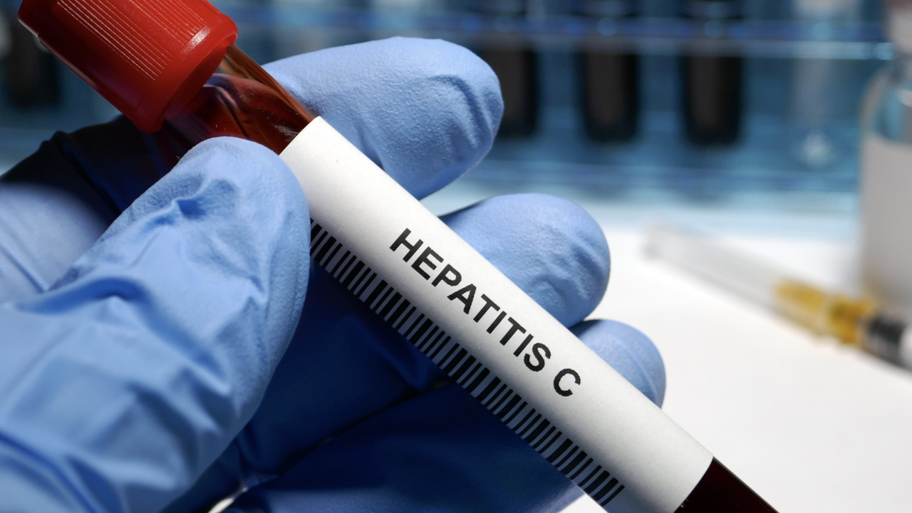 hepatitis-c-1280