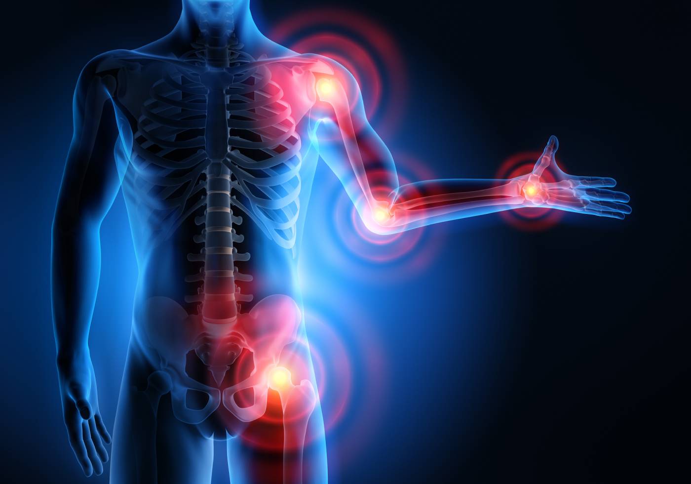 joint-pain-lead